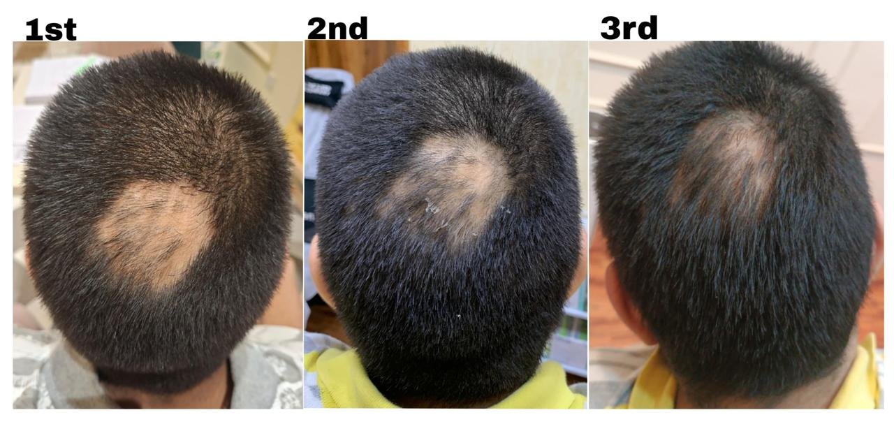 Image Clinic before after (19)